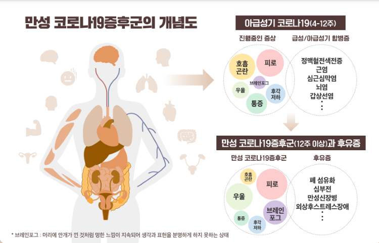 만성-코로나19증후군의-개념도