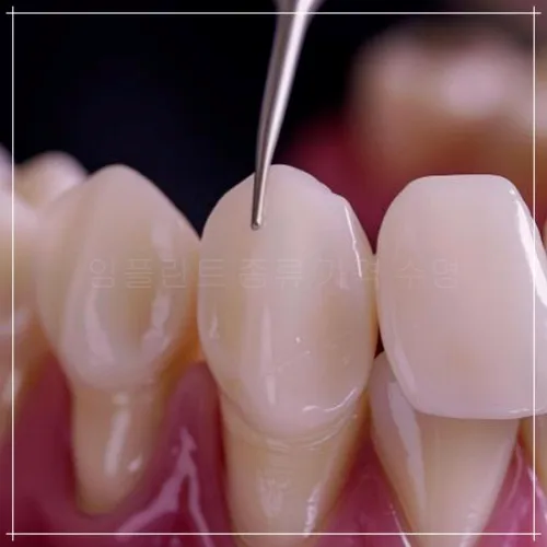 원피스 임플란트: 특징, 비용, 수명2