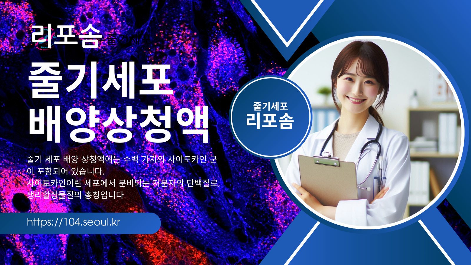 줄기세포 리포솜