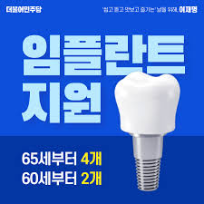 임플란트 가격
