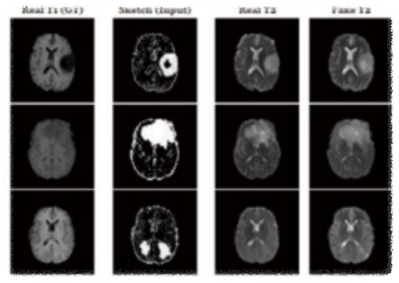 딥페이크(Deepfake) 기술 적용 의료 영상- 출처:Ground AI