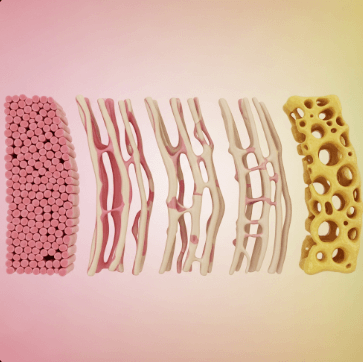 골다공증 원인별 치료방법3