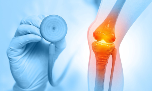 관절 건강 챙기기