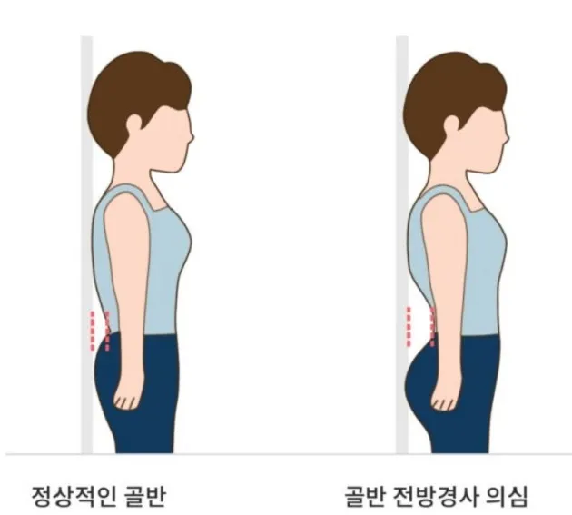 전방경사셀프체크선자세