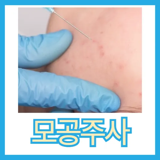 여드름 모공주사 모공확대 모공주사 효과 부작용