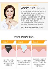 CO2레이져