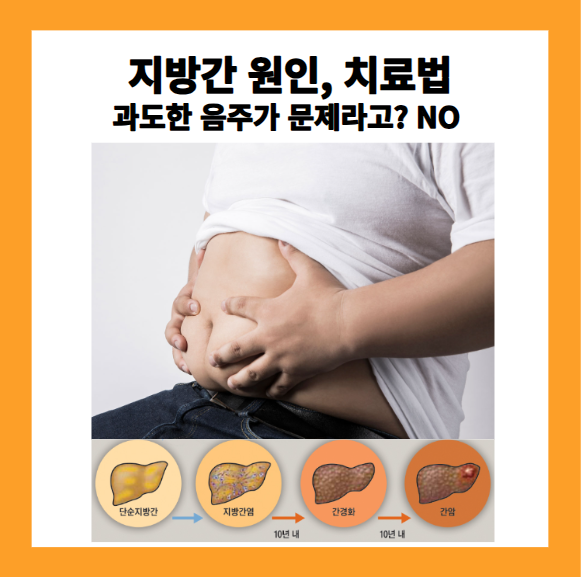지방간 치료,원인
