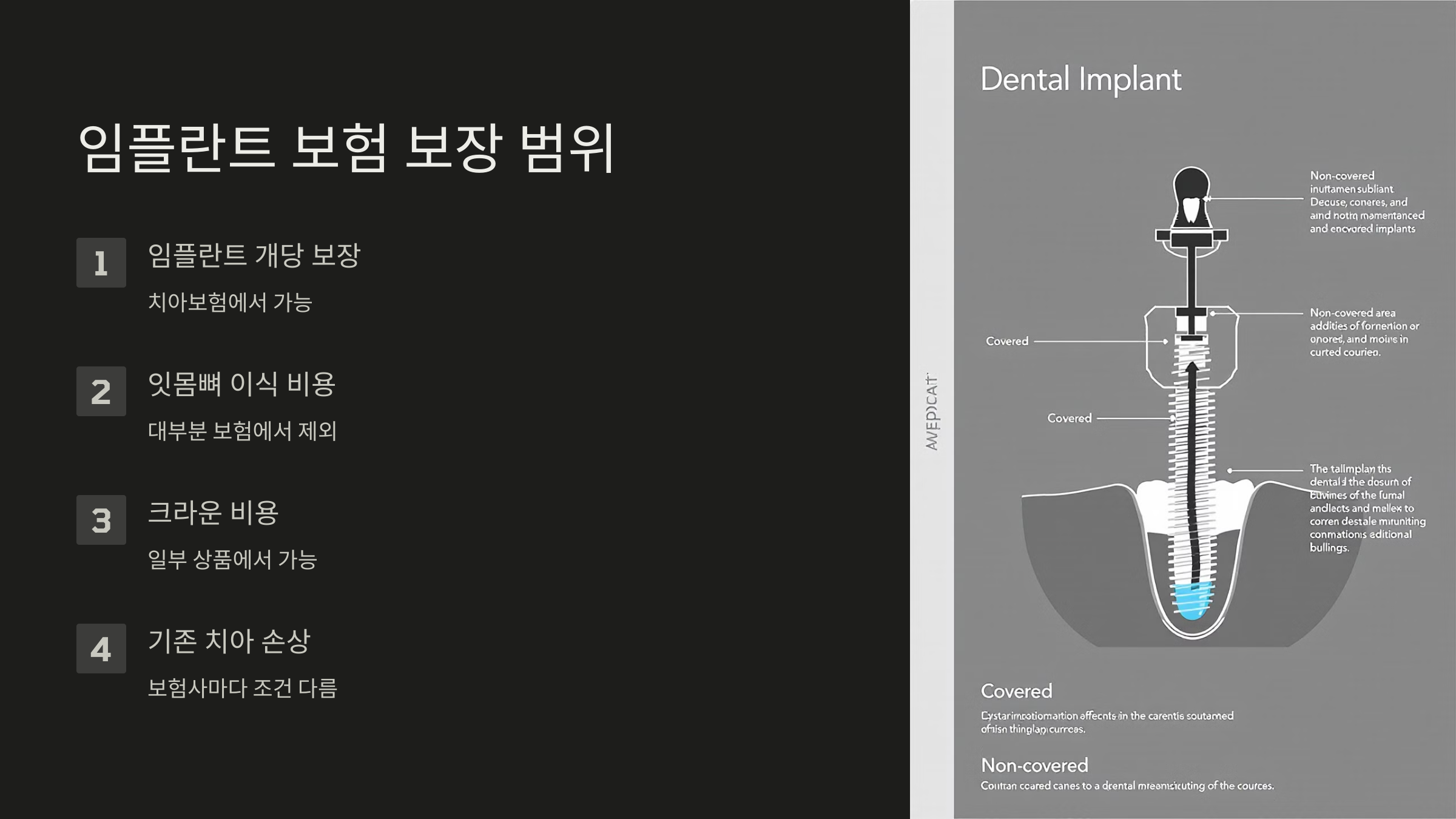 임플란트 보험 보장 범위