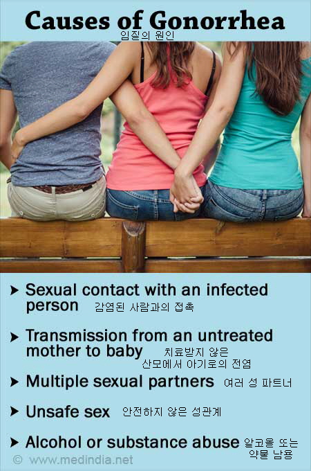 흔한 성병 임질 구체적인 설명과 질의 응답