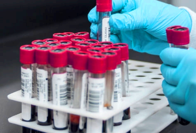 혈액암 증상과 초기증상&amp;#44; 생존율은?