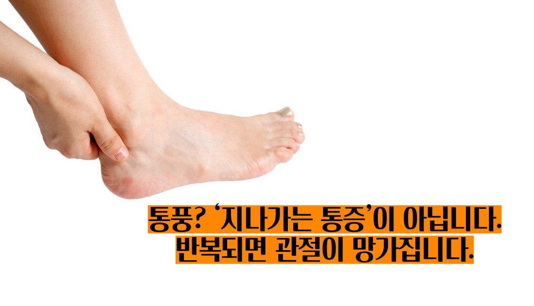 급성 통풍
