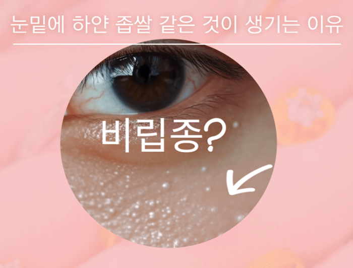 눈밑에 하얀 좁쌀