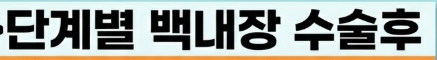 백내장 수술후 시력회복 기간
