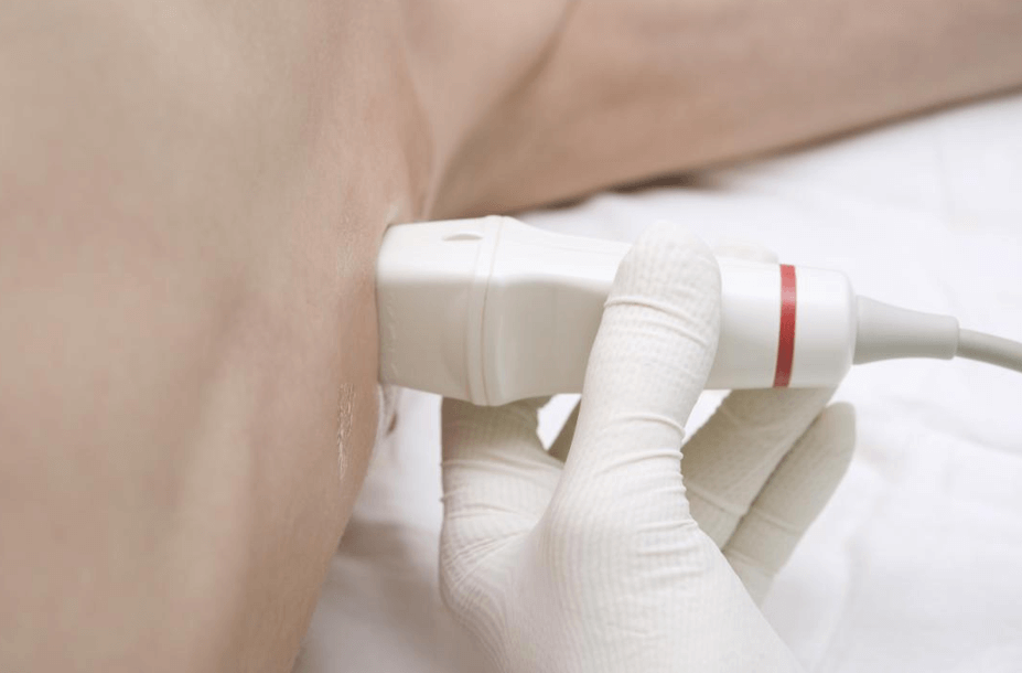 겨드랑이-초음파-사진