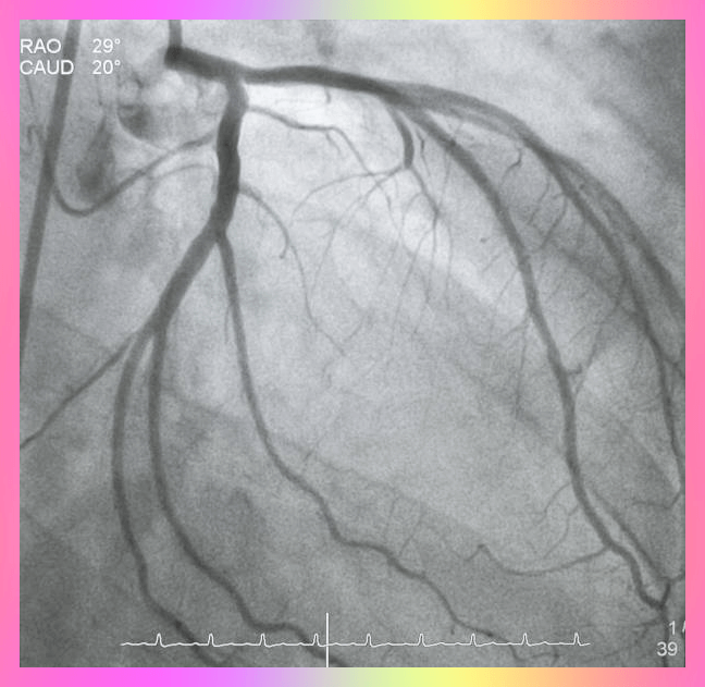왼쪽가슴-통증이유