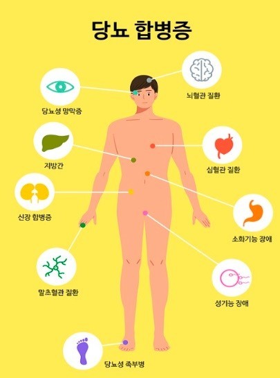 당뇨병
