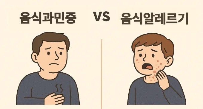 음식과민증 검사