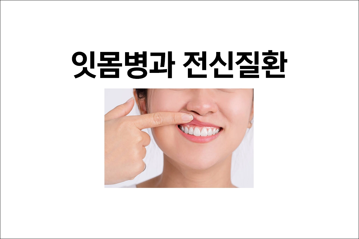잇몸병과 전신 질환 고혈압 뇌졸중 당뇨 류머티즘 관절염