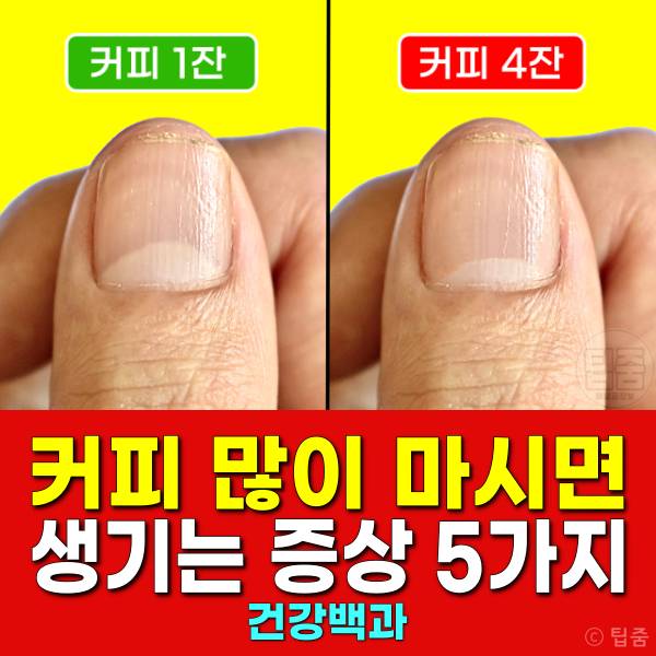 커피 많이 마시면 커피과다복용 부작용