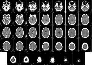 건강검진 금식시간