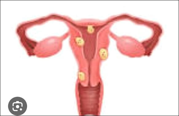 왼쪽 아랫배 통증 원인과 치료법