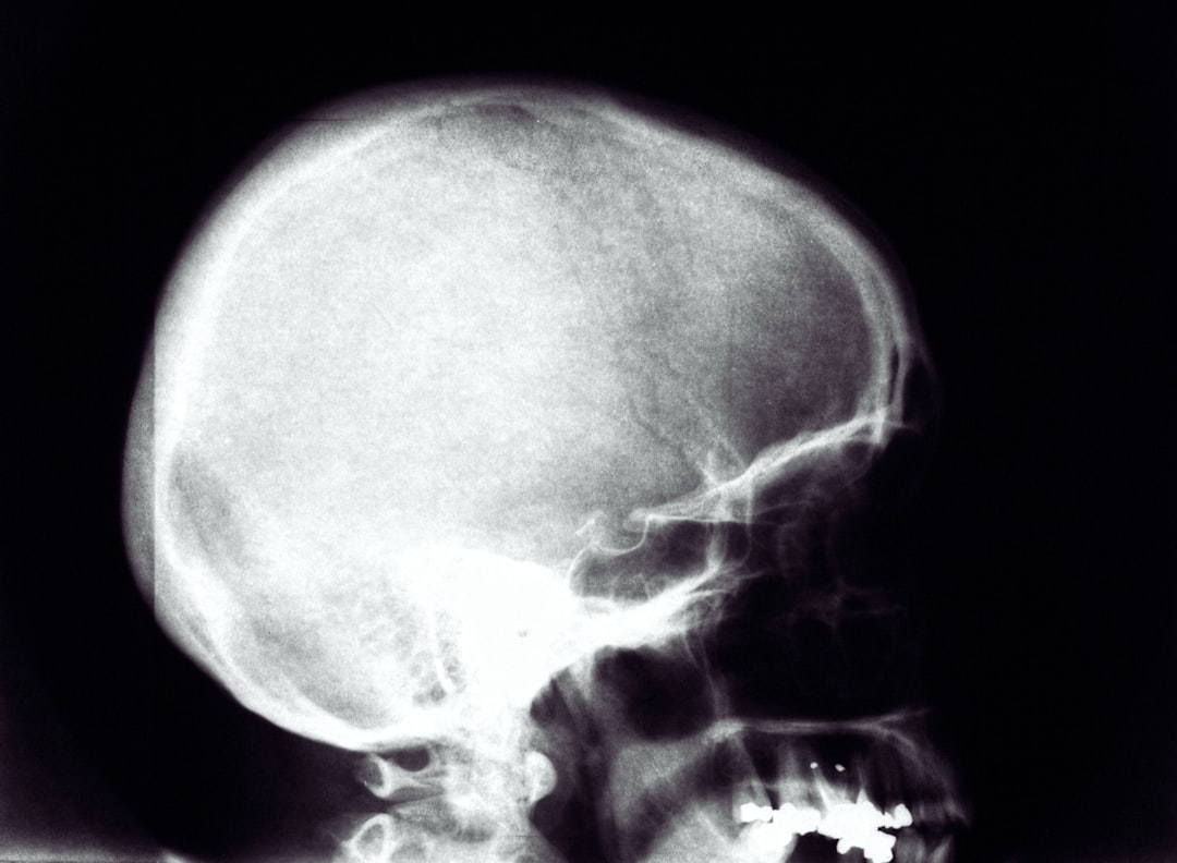 BPH (Benign Prostatic Hyperplasia)