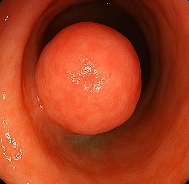 선종 뜻 선종과 용종의 차이