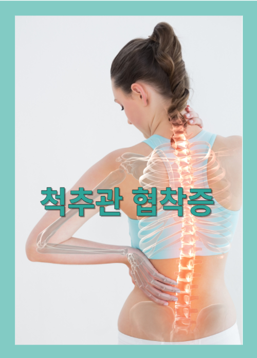 척추관 협착증
