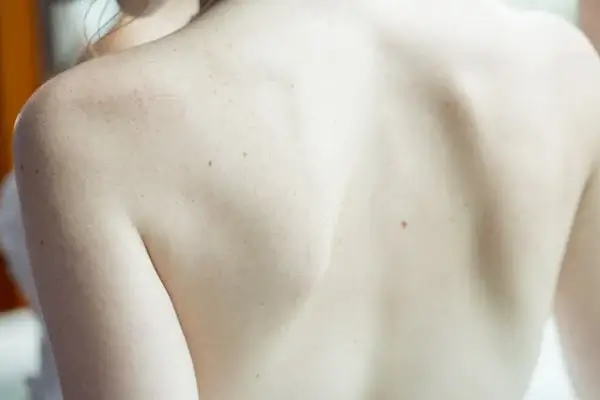 건조한 겨울 겨울 불청객 피부건증