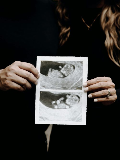 태동 느끼는 시기부터 시기별 태동 정보 + 태동 검사