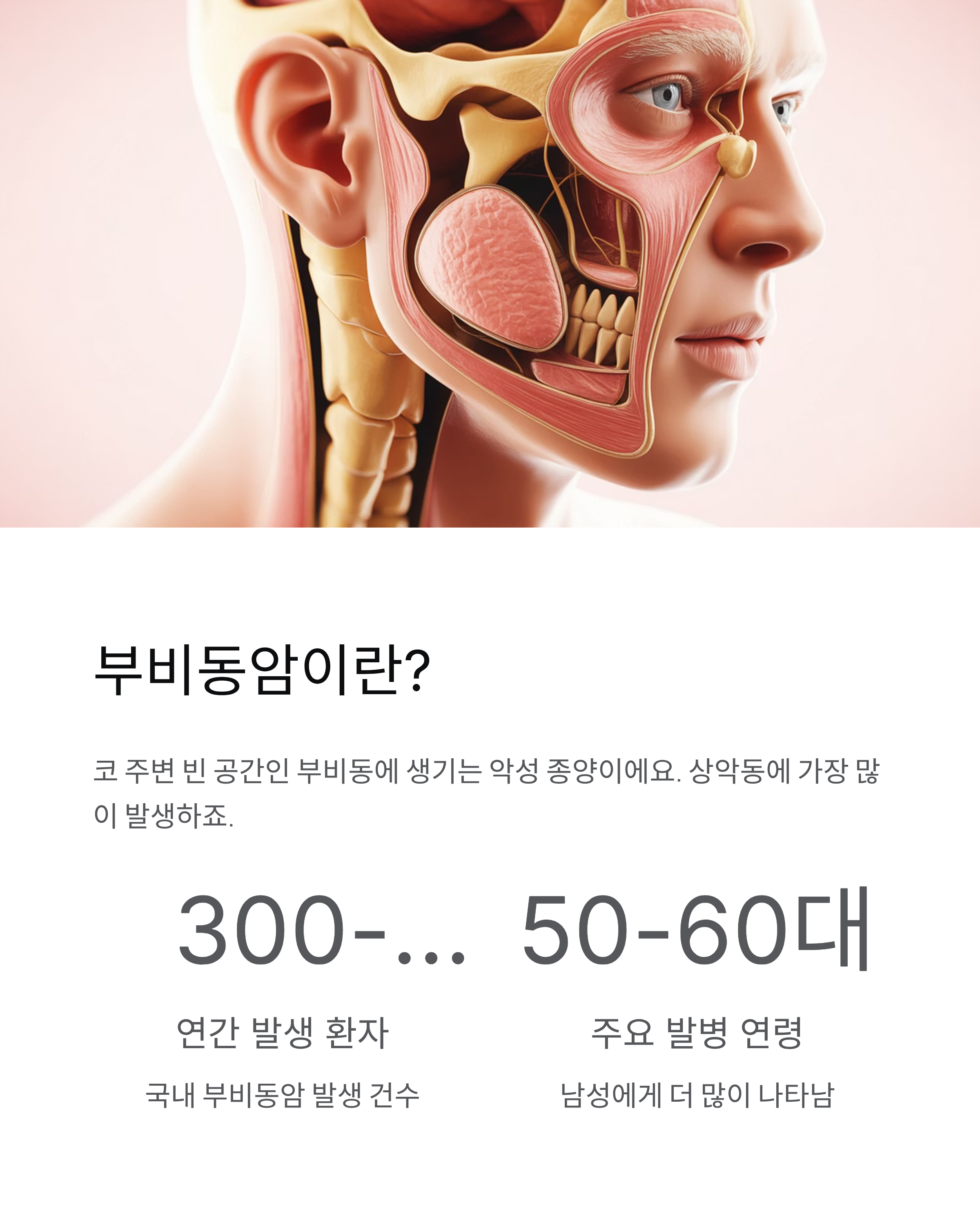 부비동암 초기증상과 생존율, 꼭 알아야 할 모든 것