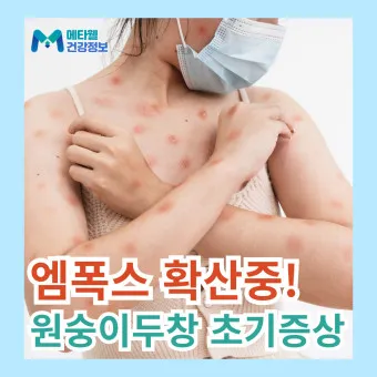 엠폭스 증상 예방접종 대처법 치료방법_21