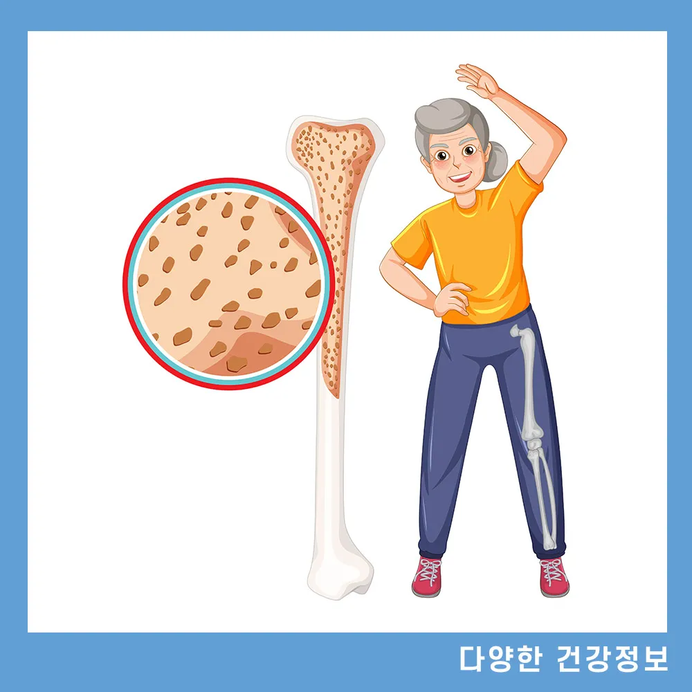 골다공증 주사 치료