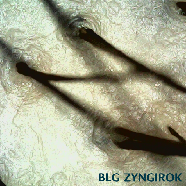 피나모아 복용 8주차 두피사진 - 정수리 위치 모습이다.