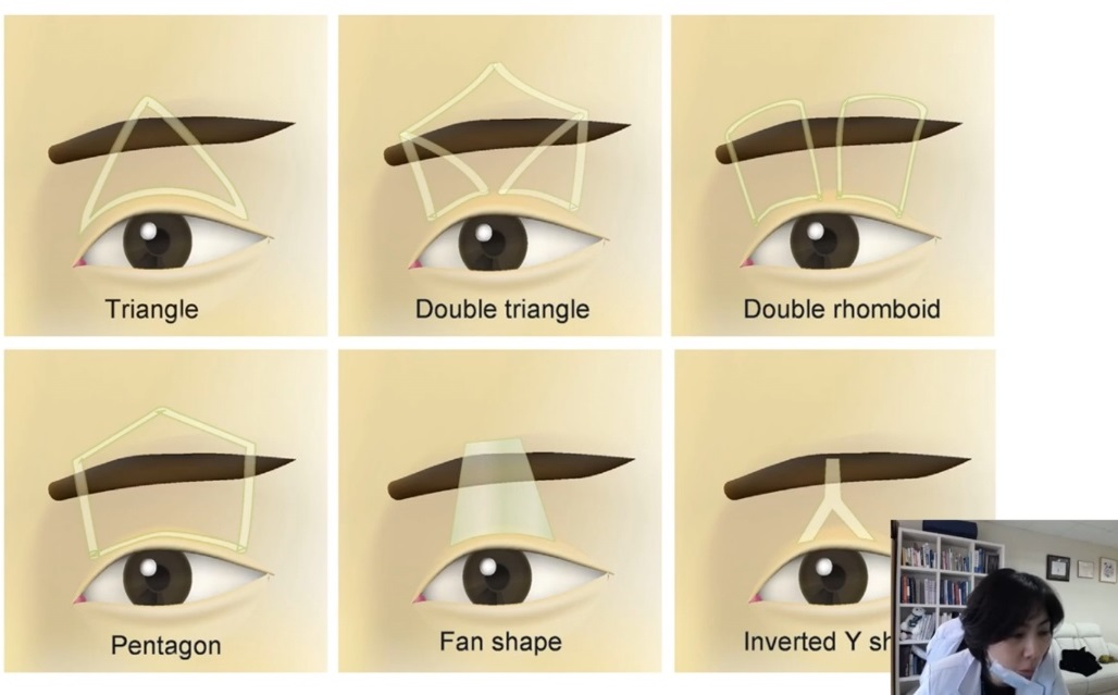 EBS명의-안검하수-안성형-성형안과-윤진숙-교수