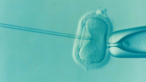 체외수정(IVF) 과정 A to Z - 시험관 아기 시술의 모든 것