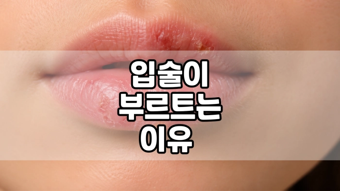 입술이 부르트는 이유