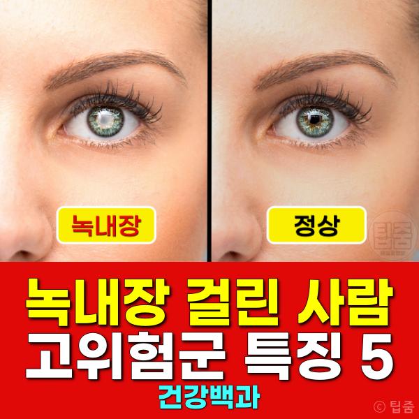 녹내장 잘 걸리는 사람 고위험군 특징