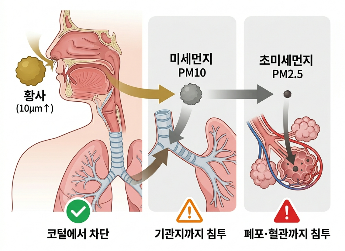 초미세먼지 폐포 침투, PM2.5 혈관 흡수, 미세먼지 기관지, 입자 크기 건강영향