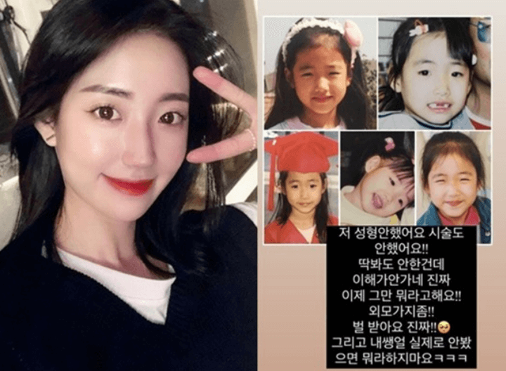 배수진이-자신의-어린시절-사진을-공개하면서-성형에-대해-반박글을-올린-모습