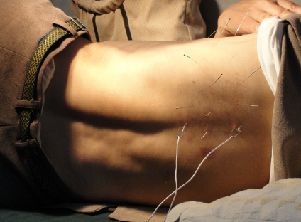 세계 각국의 전통적인 의료 및 치료 방법