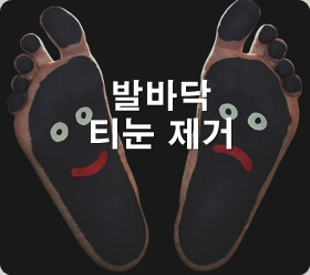 발바닥 티눈 제거