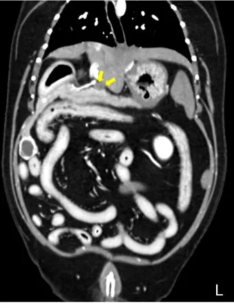 강아지 췌장암 증상 진단 치료법 안내_4