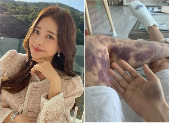 아옳이 병원 건강주사 승소