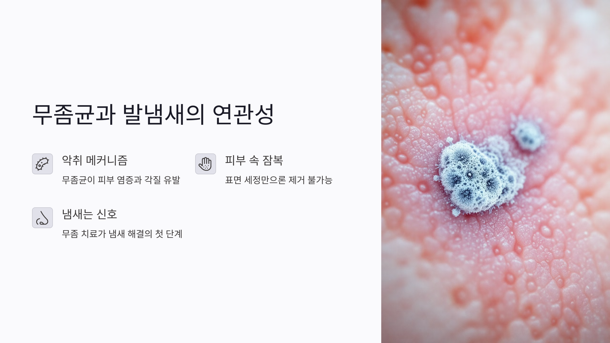 무좀균과 발냄새의 직접적 연관성: 냄새가 계속 나는 진짜 이유