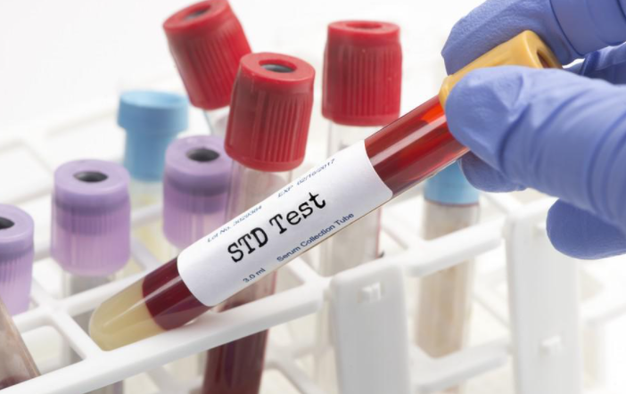 STD 12종 성병 검사