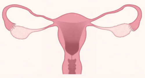 칸디다질염 원인