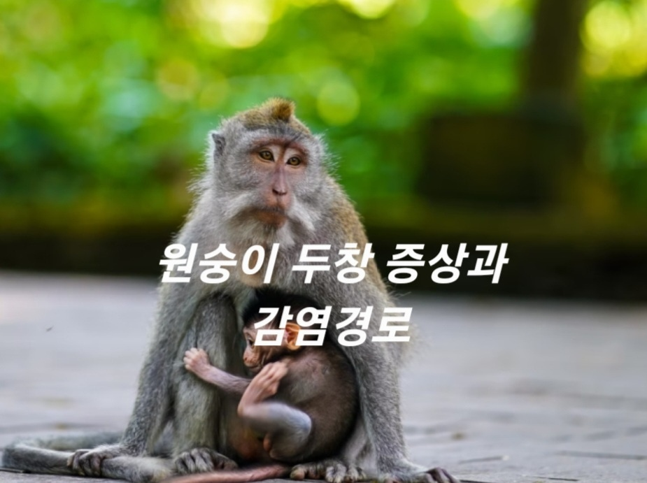 원숭이 두창