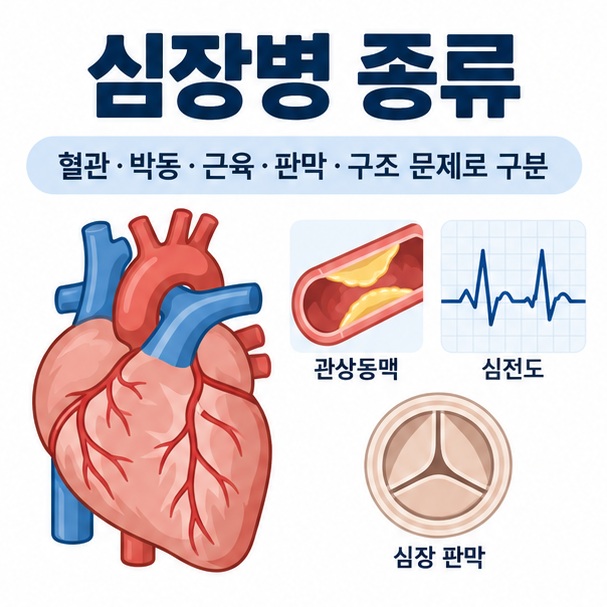 심장병 종류라는 제목과 심장, 관상동맥, 심전도, 심장판막을 함께 표현한 대표 이미지