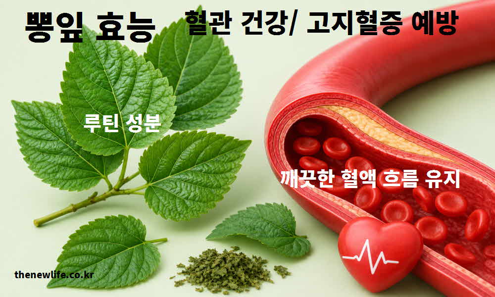 뽕잎 효능 혈관 건강 고지혈증 예방